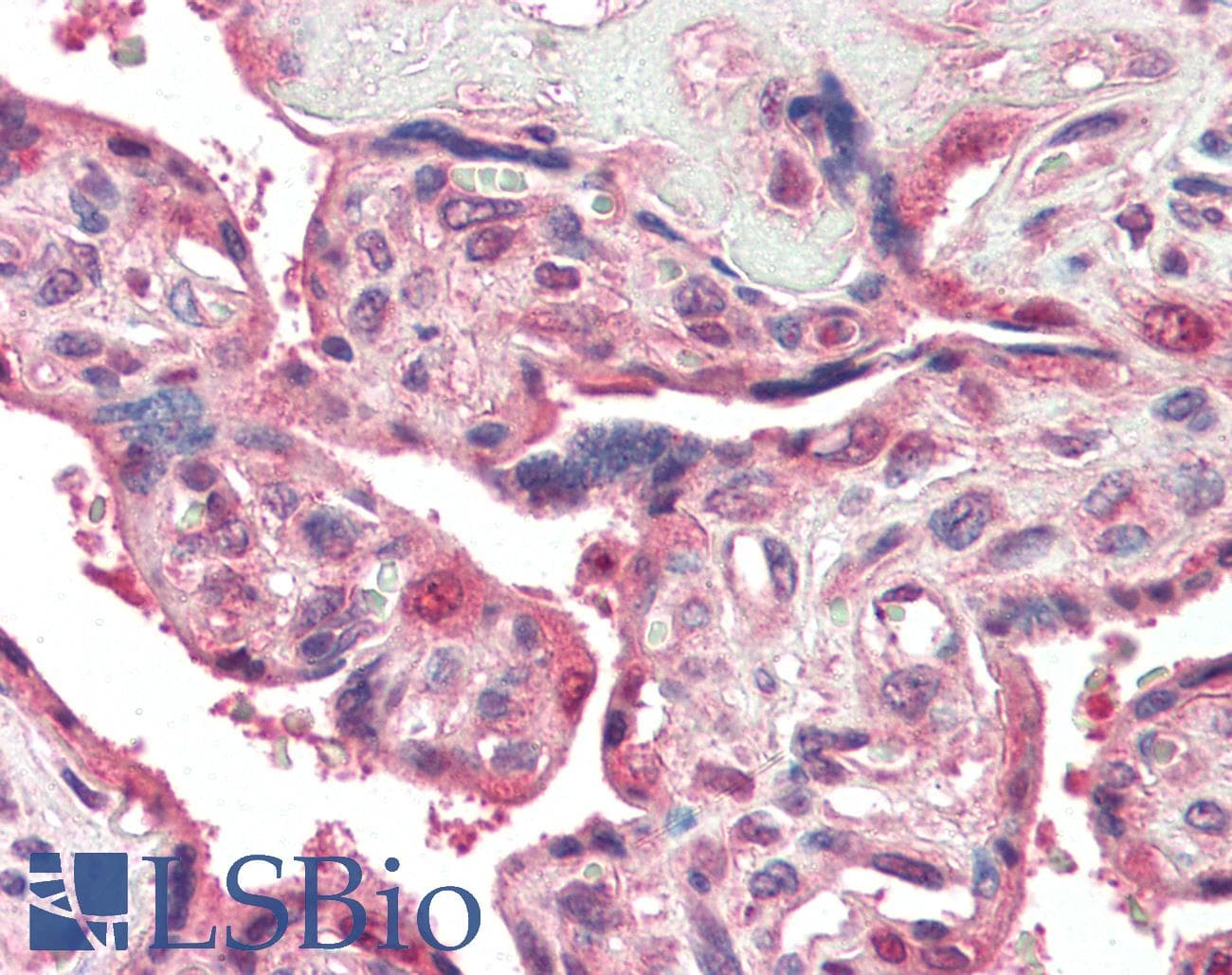 PathPlus™ PSENEN / PEN-2 Antibody
