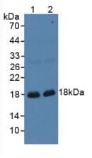 GKN1 / Gastrokine 1 Antibody (aa22-199)