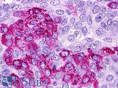 PathPlus™ Polyclonal Rabbit anti-Human S1PR1 / EDG1 / S1P1 Antibody (Cytoplasmic Domain, IHC)