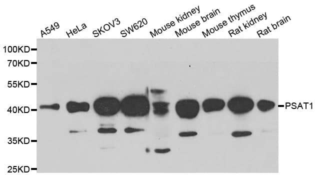 IHC-plus™ PSAT1 Antibody