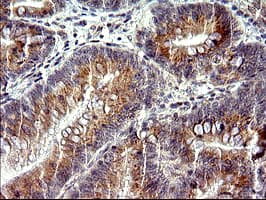 Monoclonal Mouse anti-Human CHAC1 / MGC4504 Antibody (clone OTI1E2, Carrier-free, IHC, IF, WB)