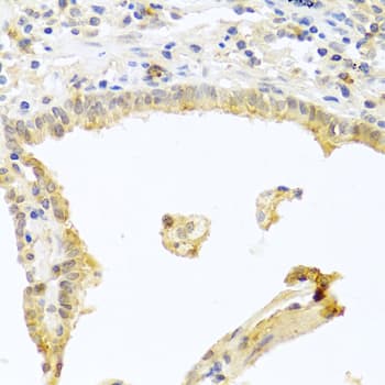 PRKCA / PKC-Alpha Antibody