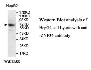 Polyclonal Rabbit anti-Human ZNF34 Antibody (aa94-361, IHC, WB)