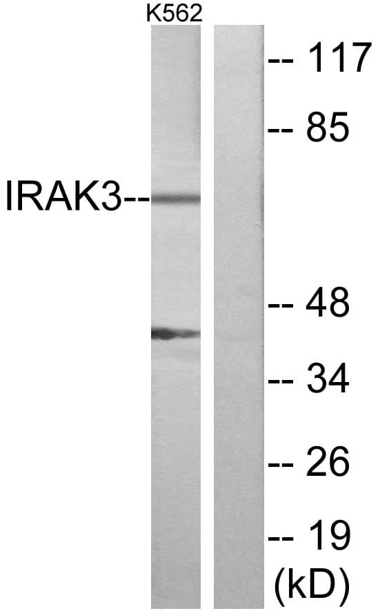 IRAK3 / IRAKM / IRAK-M Antibody (aa491-540)