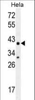CYC1 / Cytochrome C-1 Antibody (aa263-291)