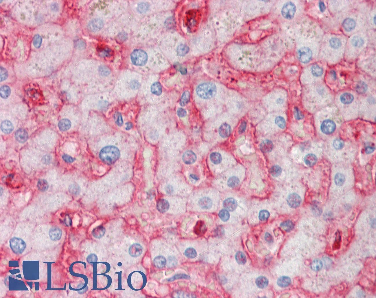 IHC-plus™ STOM / Stomatin Antibody (aa3-14)