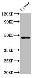 Polyclonal Rabbit anti-Human FUT8 Antibody (IHC, WB)