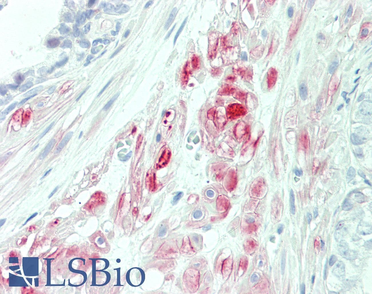 IHC-plus™ HACD1 / PTPLA Antibody (aa37-66)