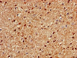 Polyclonal Rabbit anti-Human KIAA0467 / SZT2 Antibody (IHC)