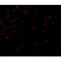 Polyclonal Rabbit anti-Human CLDN1 / Claudin 1 Antibody (IF, WB)
