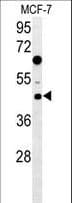 Polyclonal Rabbit anti-Human DNAJA1 / HDJ2 Antibody (aa294-323, IHC, WB)