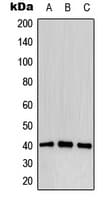 Polyclonal Rabbit anti-Human CD32B Antibody (phospho-Tyr292, WB)