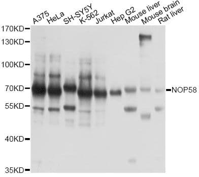 Polyclonal Rabbit anti-Human NOP58 / NOP5 Antibody (WB)