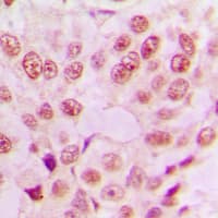 Polyclonal Rabbit anti-Human RELA / NFKB p65 Antibody (Internal, IHC, IF, WB)
