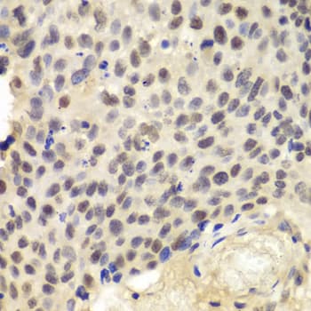 KPNA1 / Importin Alpha 5 Antibody