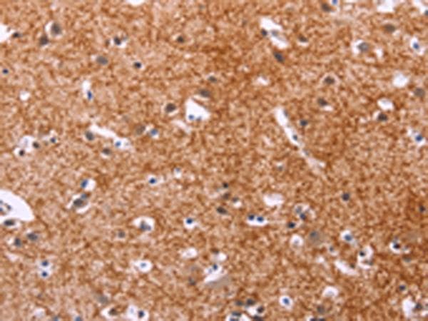 APMAP / C20orf3 Antibody