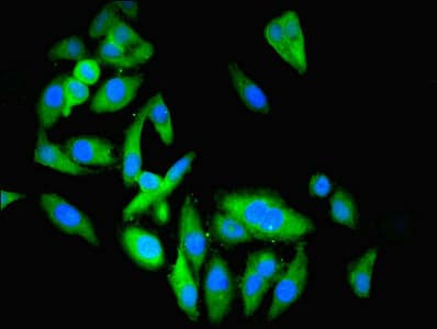 Polyclonal Rabbit anti-Human ENO3 / Enolase 3 Antibody (IHC, WB)