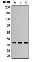 MAP2K4 / MKK4 Antibody (Internal)