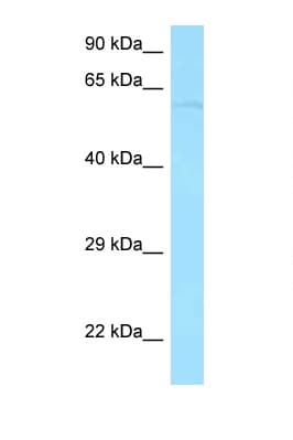 PPP2R3B Antibody (aa94-143)