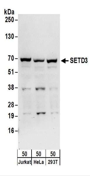 SETD3 Antibody (aa544-594)