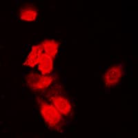 Polyclonal Rabbit anti-Human SIAH1/SIAH2 Antibody (Internal, IHC, IF, WB)