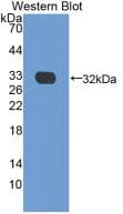 CRP / C-Reactive Protein Antibody (clone C4, Biotin)