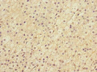 LRP4 Antibody