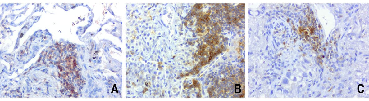 Monoclonal Mouse anti-Human PDCD1 / CD279 / PD-1 Antibody (clone UMAB199, IHC, IF, WB)