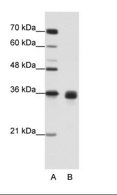 Polyclonal Rabbit anti-Human WNT2B Antibody (aa229-278, IHC, WB)