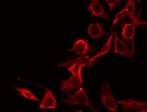 PPP2R1B Antibody