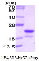 Human RFK Protein (Recombinant His)