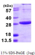 Human SPSB1 Protein (Recombinant His)