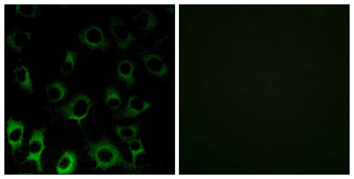 IHC-plus™ Polyclonal Rabbit anti-Human RPS4X + RPS4Y1 + RPS Antibody (aa81-130, IHC, IF, WB)