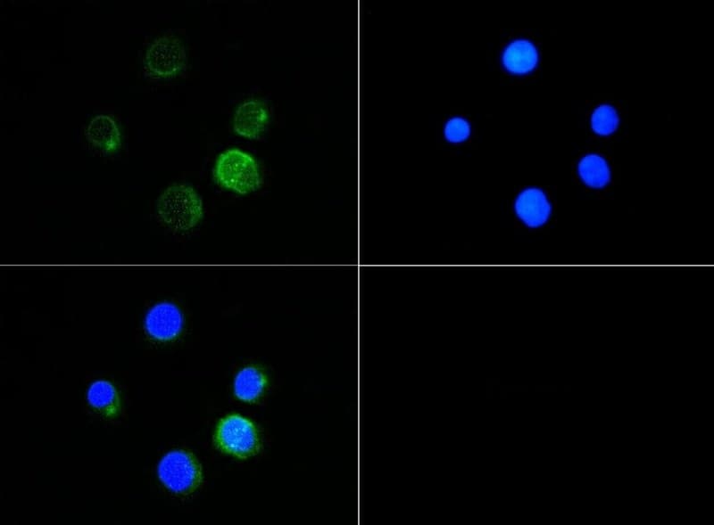 BTK Antibody (phospho-Tyr223, DY650)