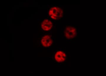 Polyclonal Rabbit anti-Human ESR2 / ER Beta Antibody (aa94-118, IHC, IF, WB)