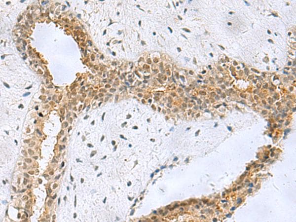 NABP1 / OBFC2A Antibody