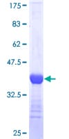 Human Eomesodermin / EOMES Protein (Recombinant GST, N-terminus)