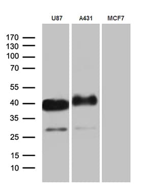 PDPN / Podoplanin Antibody (aa23-131, clone OTI7B4)