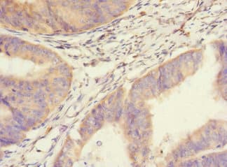Polyclonal Rabbit anti-Human SAV1 / WW45 Antibody (IHC, IF, WB)
