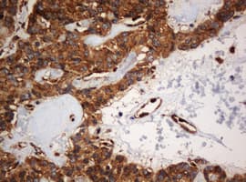PAI-RBP1 / SERBP1 Antibody (aa1-262, clone OTI1E7)