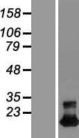 TMEM92 Protein (Over-Expression Lysate Myc-DDK (Flag))