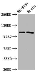 FBXO10 Antibody