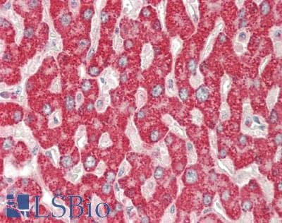 IHC-plus™ Polyclonal Rabbit anti-Human GBA / Glucosidase Beta Acid Antibody (aa117-214, IHC, WB)