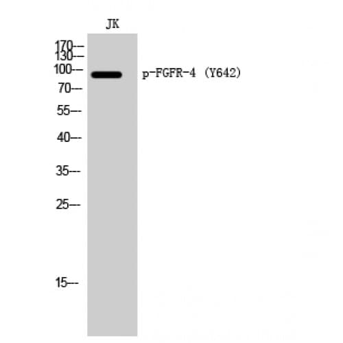 FGFR4 Antibody (580-660 aa)