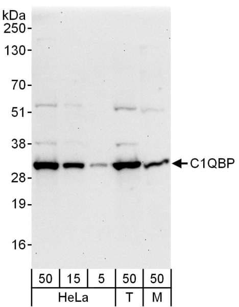 GC1qR / C1QBP Antibody (aa232-282)