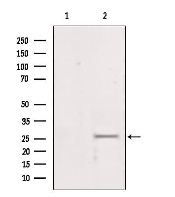 LGALS3 / Galectin 3 Antibody