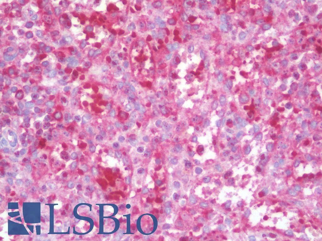 IHC-plus™ Polyclonal Rabbit anti-Human MAP1LC3C / LC3C Antibody (IHC, IF, WB)