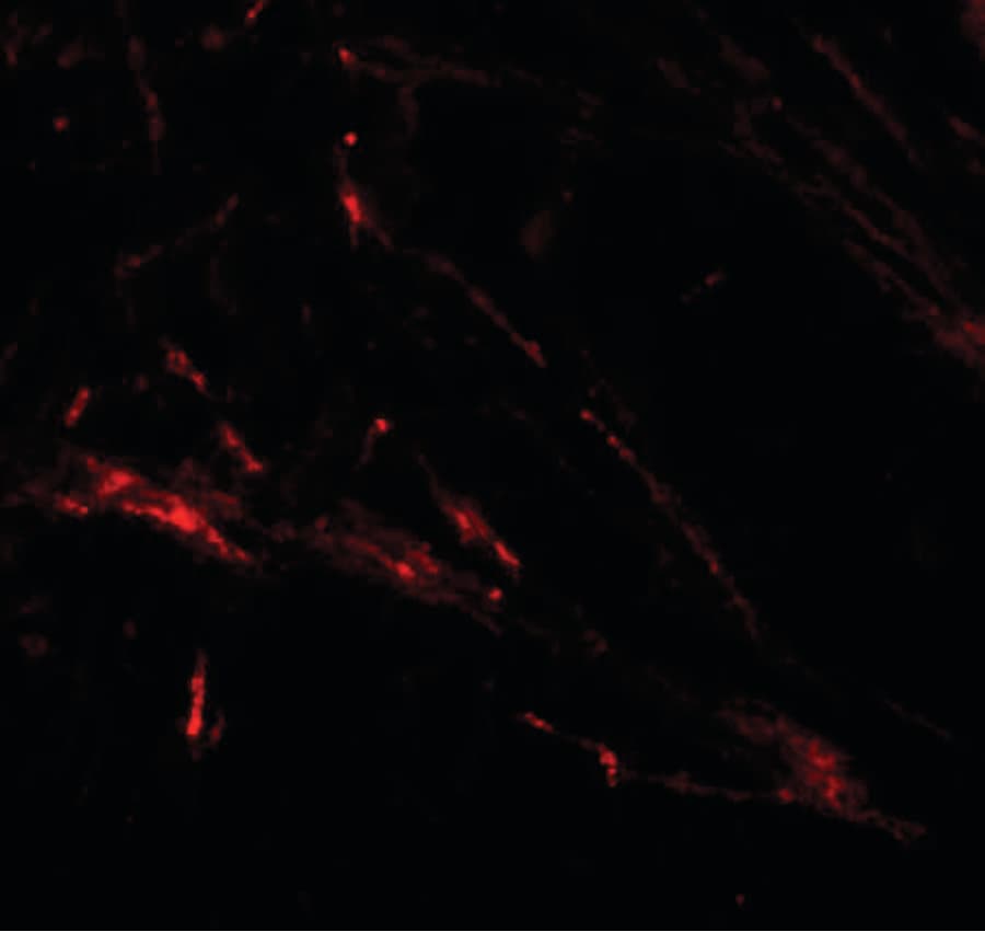 IHC-plus™ Polyclonal Rabbit anti-Human SLC39A7 / ZIP7 Antibody (IHC, IF, WB)