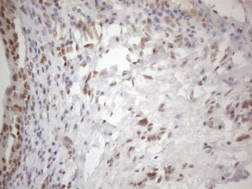 WTAP Antibody (aa2-106, clone OTI6H3)