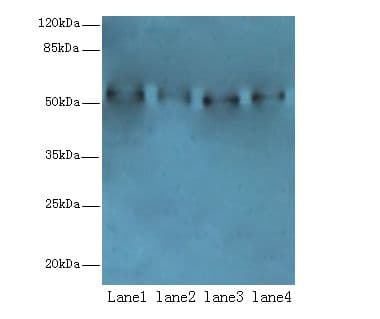 Polyclonal Rabbit anti-Human TRIM15 Antibody (IHC, WB)